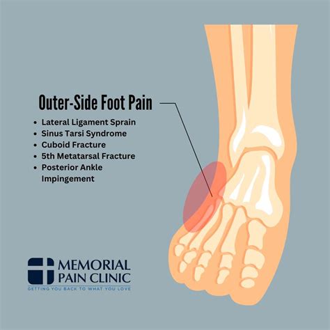 foot pain chart common foot problems memorial pain clinic