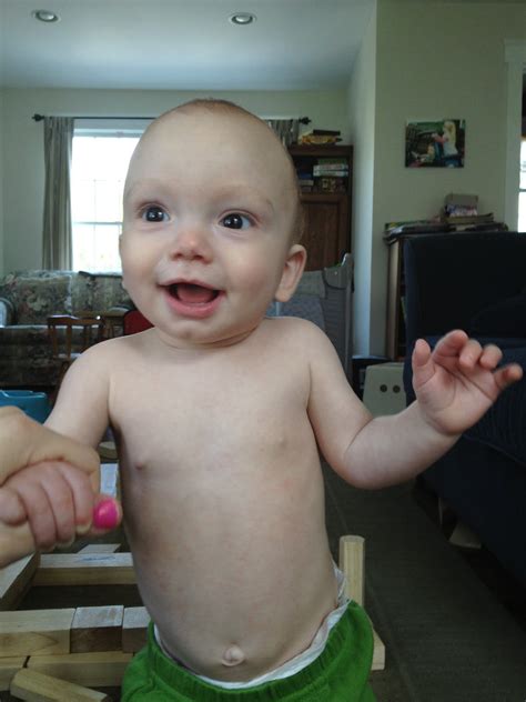 Hestermania!: Roseola and a First Tooth