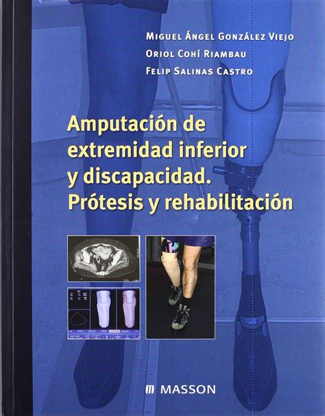 Amputación de extremidad inferior y discapacidad prótesis y