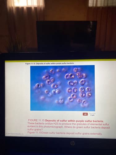 Chapter 11 microbiology Flashcards | Quizlet 