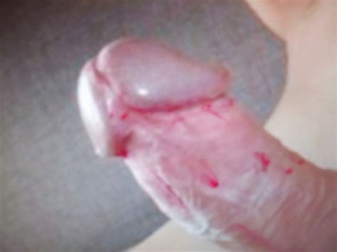 COCK WHIP Porn Pictures XXX Photos Sex Images 405406 PICTOA