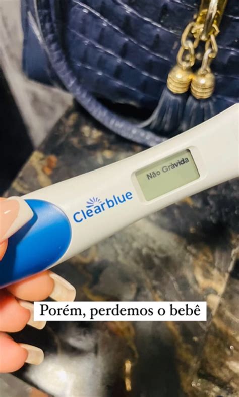 Ex Bbb Patr Cia Leitte Revela Ter Sofrido Aborto Espont Neo Deus Me