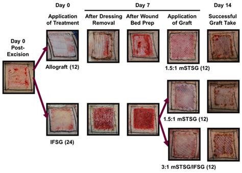 Comparison of Intact Fish Skin Graft and Allograft as Temporary