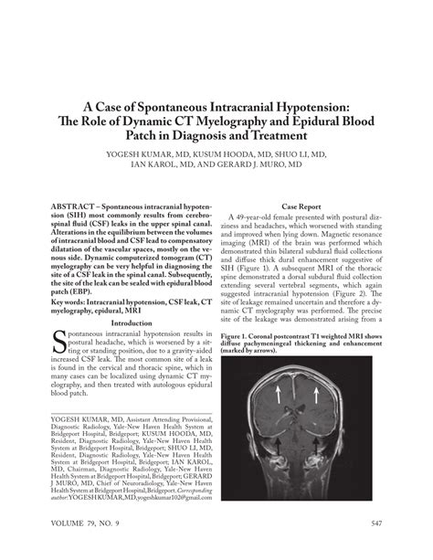 (PDF) A Case of Spontaneous Intracranial Hypotension: The Role of Dynamic CT Myelography and ...