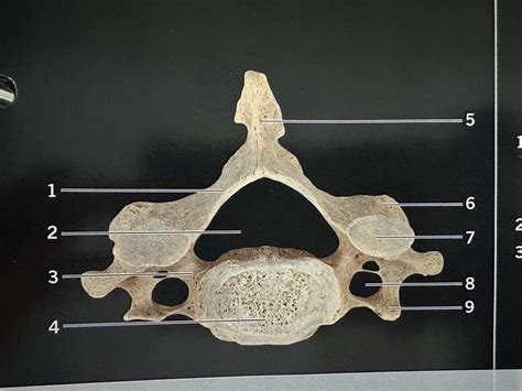 Cervical Vertebrae Superior View Diagram Quizlet