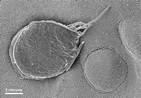 Free Picture Giardia Muris Protozoan Adhering Microvillous Border