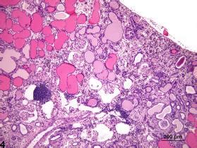 Kidney Nephropathy Chronic Progressive Nonneoplastic Lesion Atlas