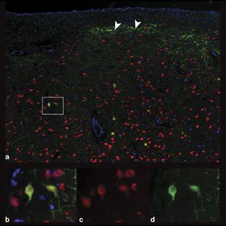 Astrocytic Transduction By AAV2 9 GFAP Positive Astrocytes Of The