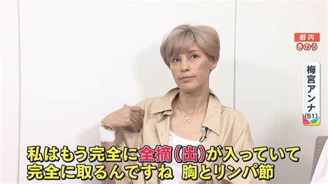 「絶対死なない」乳がんステージ3公表・梅宮アンナが語る“闘病への決意”「私にしかできないことをやっていく」【単独インタビュー】の画像ページ