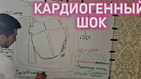 КАРДИОГЕННЫЙ ШОК - YouTube