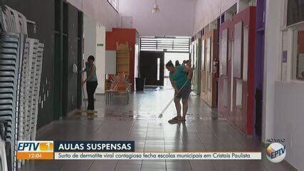 Surto De Dermatite Suspende Aulas Em Escolas De Cristais Paulista Sp