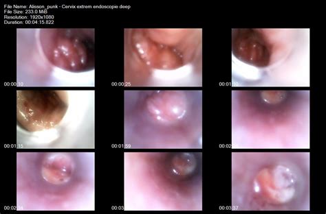 Xtreme Pussy Fisting Object Insertion Videos Page