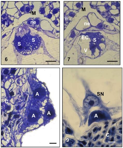 Synergid cells in mature embryo sac of L. aestivum. (Longitudinal ...