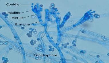 Penicillium camemberti - Alchetron, The Free Social Encyclopedia