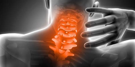 O que é Cervicalgia Quais as causas sintomas e tratamento