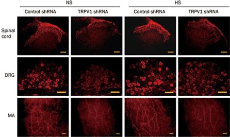 Immunohistochemistry Staining Showing Trpv1 Expression In The Dorsal