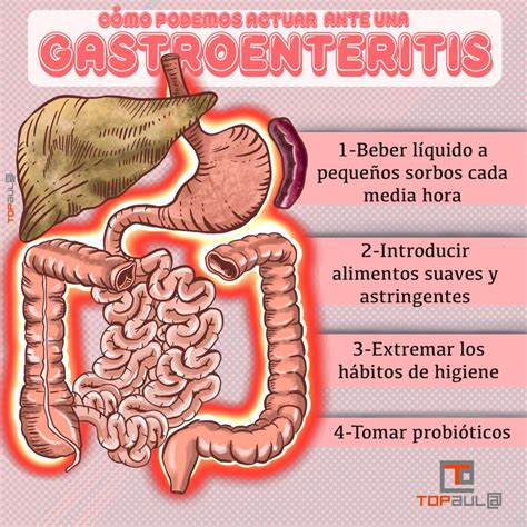 C Mo Podemos Actuar Ante Una Gastroenteritis Top Aul