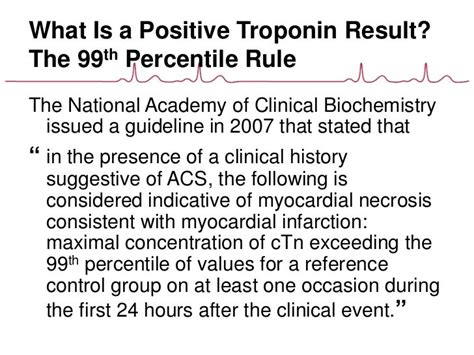 How To Interpret Elevated Cardiac Troponin Levels