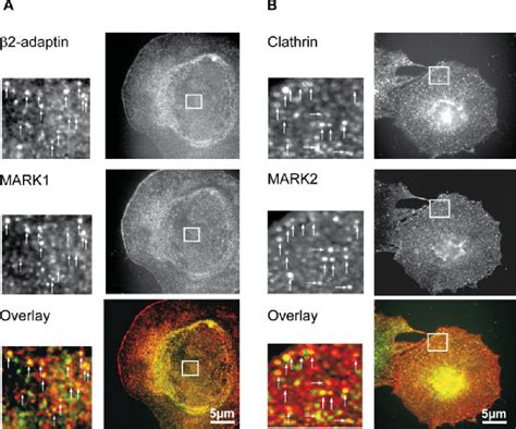 Figure From Interactions Of Map Microtubule Affinity Regulating