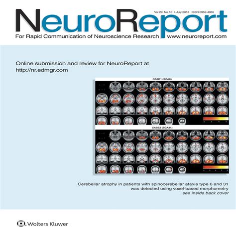 Sex Differences In A Chronometric Mental Rotation Test With NeuroReport