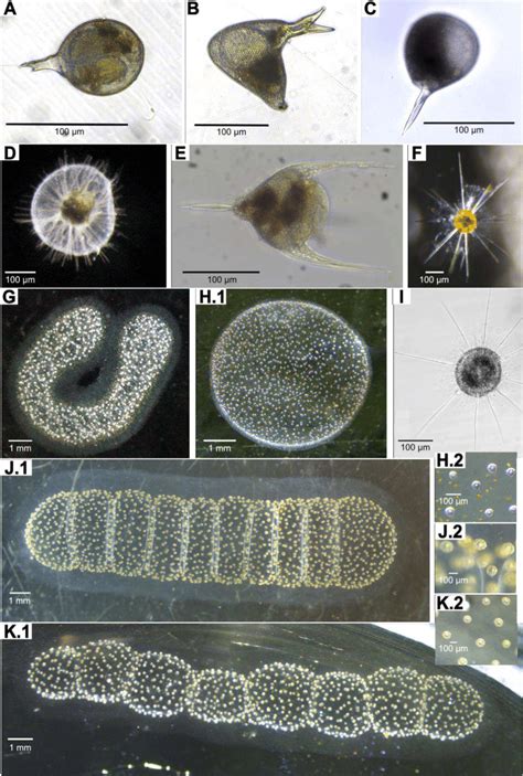 Light microscopy image examples of the Rhizaria studied. A Protocystis ...