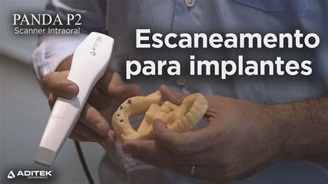 Escaneamento Para Implantes O Scanner Intraoral Panda P2 Aditek