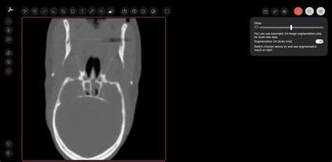 mri viewer  dicom reader  editor