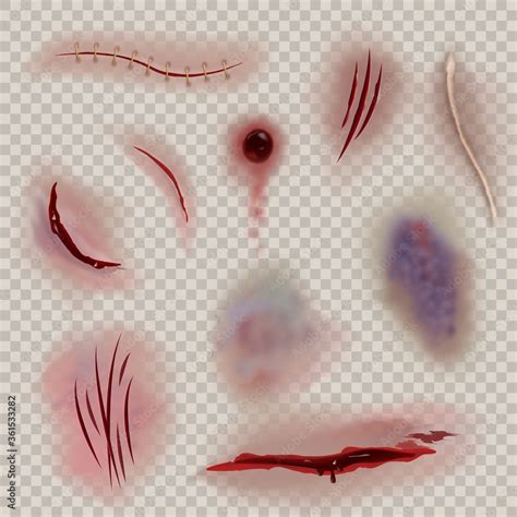 Bloody Wounds Realistic Various Scars Wound And Stitch Slaughter