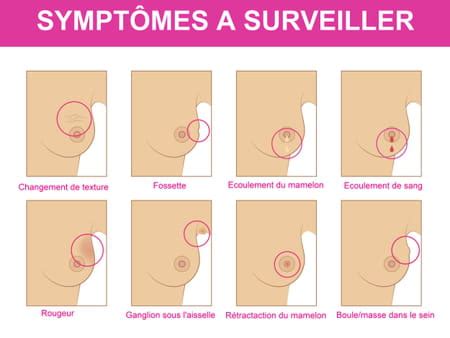 Premiers Sympt Mes D Un Cancer Du Sein Surveiller