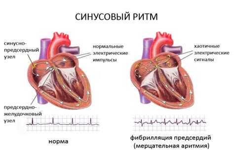Аритмия - симптомы и лечение | Медицинский центр Med & Care