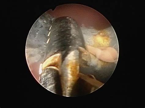 Man Rushed To Hospital For Surgery After Jamming 7in Sex Toy So Far Down His Todger It Lodged In