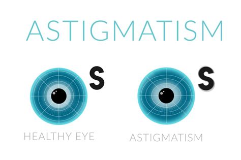 Complete Guide To Astigmatism Faqs How To Fix It