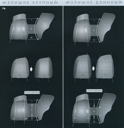 Эффекты формы керамического винира для компенсации длины и ширины зуба