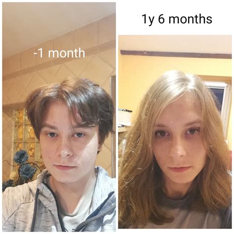 30yo Mtf For The First Time I Think Im Making Any Progres Since Starting Hrt What Do You