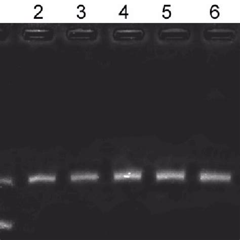 Effect Of Teniposide On DNA Relaxation By Placental Preparation