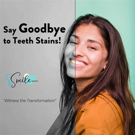 Teeth Discoloration: Causes, Symptoms, Remedies, and Commonly Asked