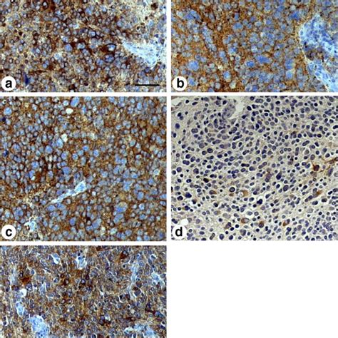 Immunohistochemical Demonstration Of A Chromogranin A B