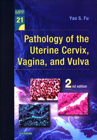 Pathology Of The Uterine Cervix Vagina And Vulva Medicine Health Science