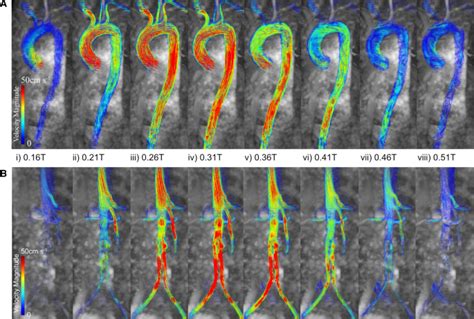 Reconstruction And Validation Of Arterial Geometries For Computational