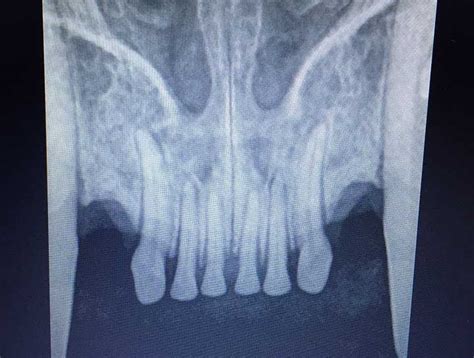 Dental Digital Radiology Cat Dental Xray