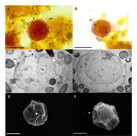 In Vitro Induction Of Entamoeba Gingivalis Cyst Like Structures From Trophozoites In Response To