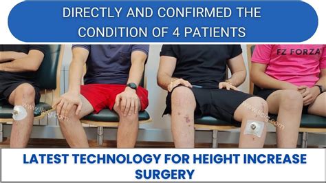 Height Increase Surgery By Mtn Method Youtube