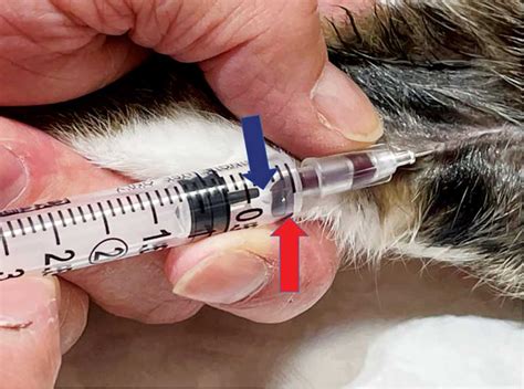 Saphenous Vein Cat