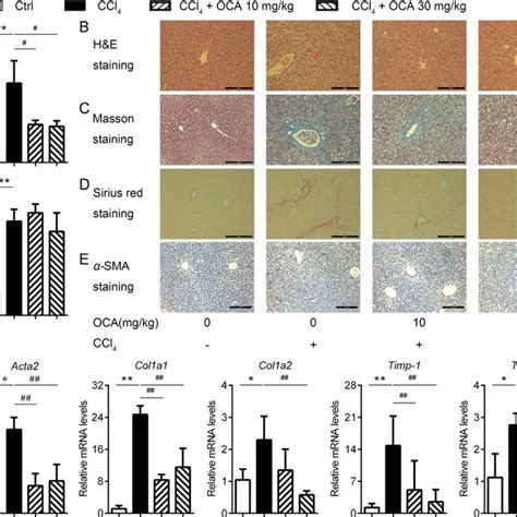 Oca Treatment Alleviates Ccl Induced Hscs Activation And Liver