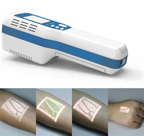Новый аппарат визуализации вен Vein Finder VIVO 500S - Медцентр "Диагност"