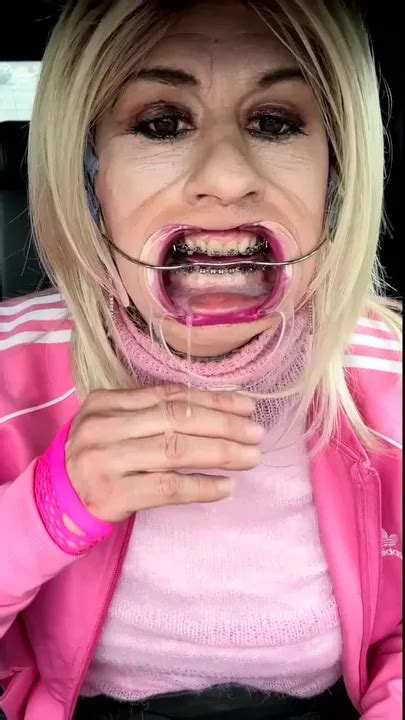 Alexandra Braces Trans Porn Videos Shemale Sex Xhamster