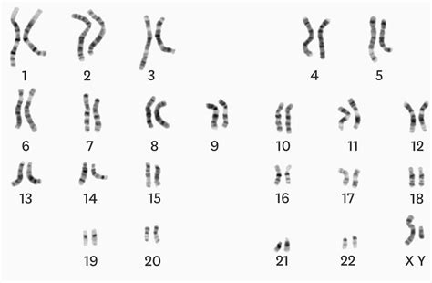 Comment R Aliser Un Caryotype