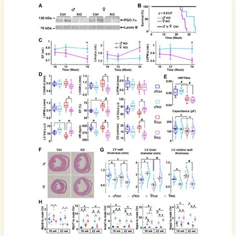 Pgc 1a Knockout Causes Sex Specific Gradual Cardiac Dilatation And