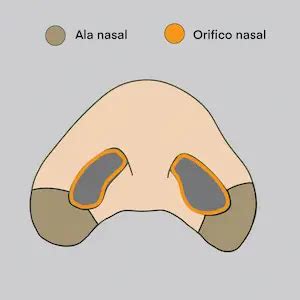 alectomia  la reduccion de fosas nasales  nariz ancha