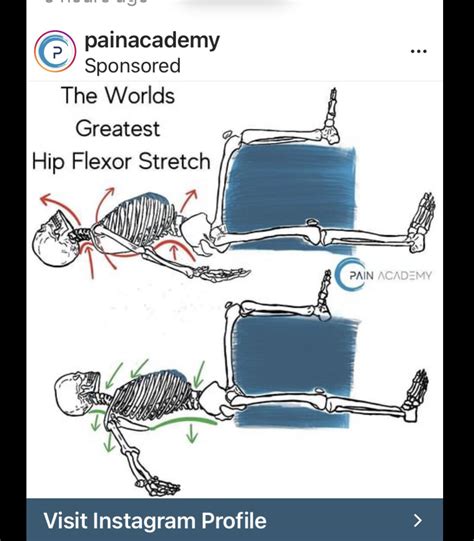Best 12 Acute Traumatic Tear of the Gluteus Medius and Gluteus Minimus